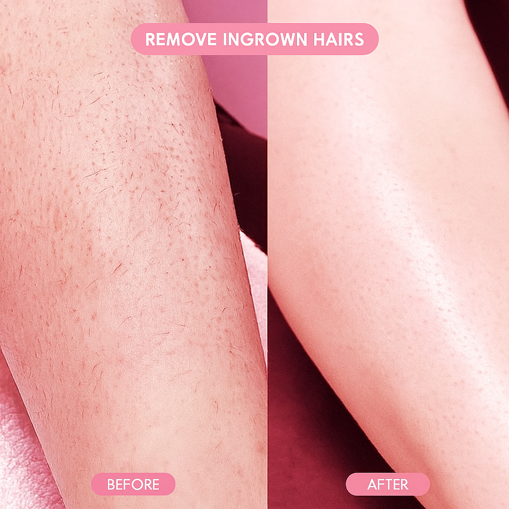 LRadianté Crystal Hair Remover